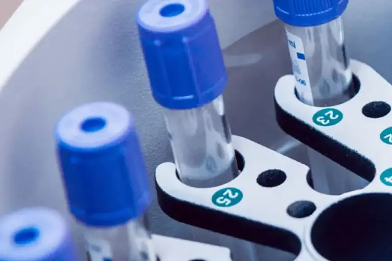 Close up of vials in a centrifuge